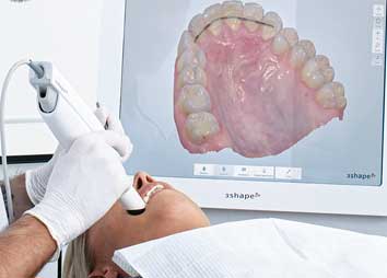 Интраоральный 3D-сканер